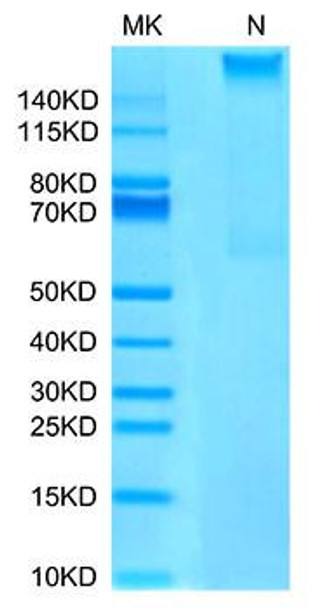 Recombinant Human MAGE-A4 (HLA-A*02:01) Complex Tetramer Protein (RPCB1625)