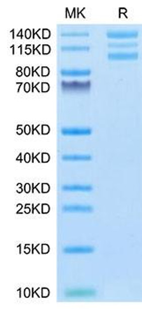 Recombinant Human Integrin alpha V beta 6 (ITGAV&ITGB6) Heterodimer Protein  (RPCB1643)