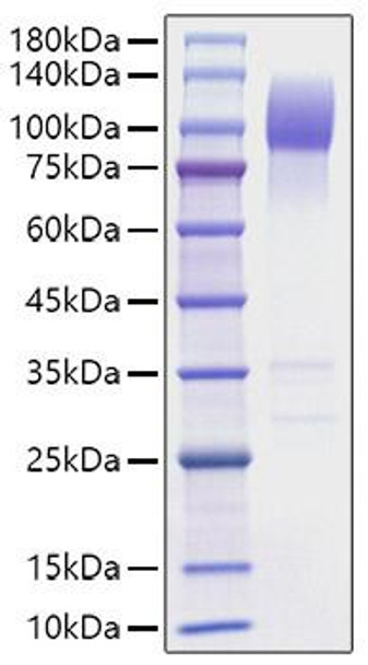 Recombinant Mouse SIRP-alpha/CD172a Protein (RPCB1646)