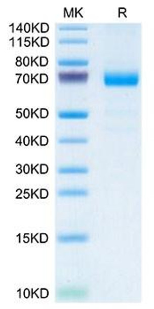 Recombinant Mouse IL-20RA Protein (RPCB1672)