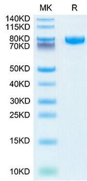 Recombinant Human IL-18 R beta/IL-1 R7/CD218b Protein (RPCB1694) Recombinant Human IL-18 R beta/IL-1 R7/CD218b Protein (RPCB1694)