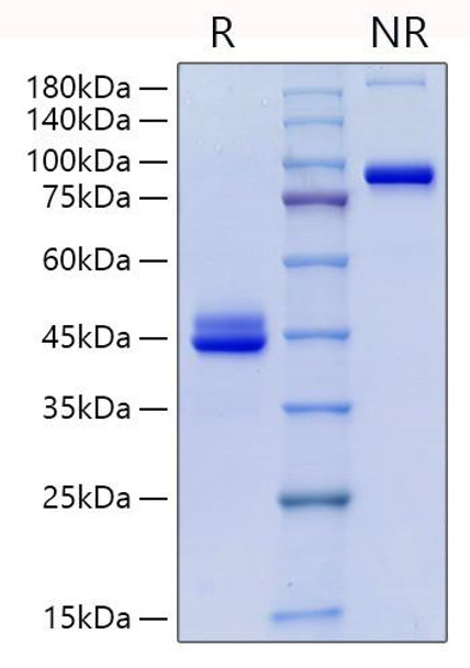Recombinant Human CD9 Protein (RPCB1711) Recombinant Human CD9 Protein (RPCB1711)