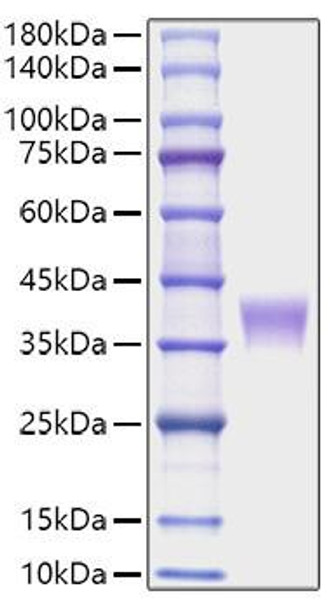Recombinant Mouse LILRB4/ILT-3/CD85k Protein (RPCB1715)