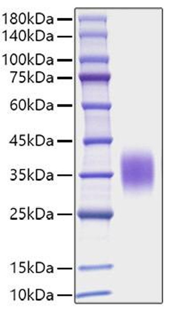 Recombinant Mouse IL-9 Protein (RPCB1716)