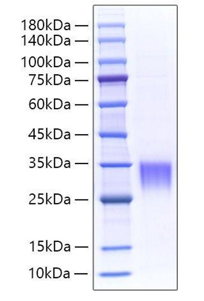 Recombinant Mouse Asprosin/Fibrillin-1/FBN1 Protein (RPCB1729)