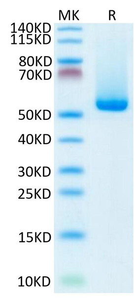 Biotinylated Recombinant  Human NY-ESO-1 (HLA-A*02:01) Complex Protein (RPCB1750)