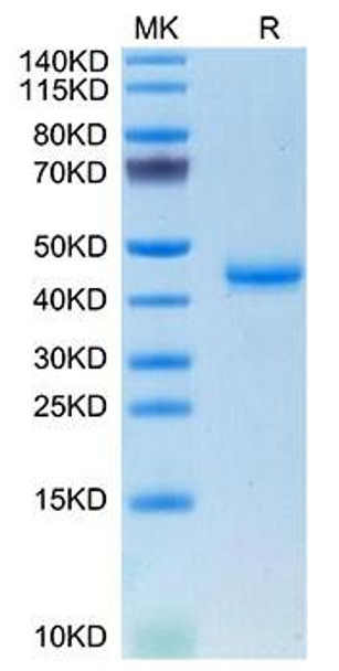 Recombinant Mouse Calcitonin/CALCA Protein (RPCB1780)