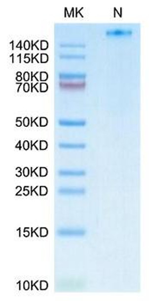 Recombinant Human NY-ESO-1(HLA-A*02:01) Tetramer Protein (RPCB1785)
