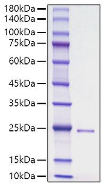 Recombinant Human HHG-3/DHH Protein (RPCB1828) Recombinant Human HHG-3/DHH Protein (RPCB1828)