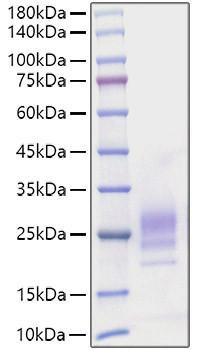 Recombinant Mouse IL-7 Protein (RPCB1840)