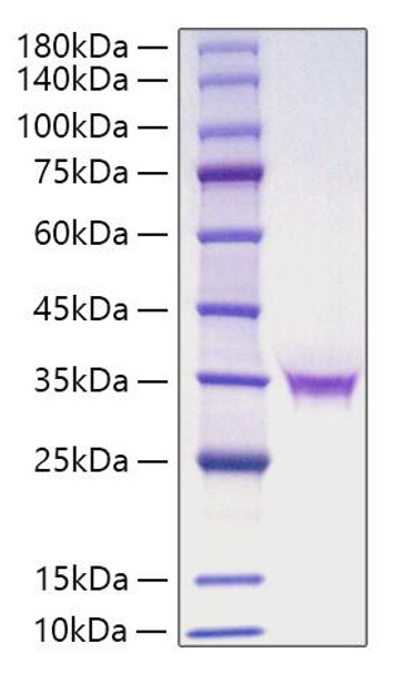 Recombinant Human FGF-18 Protein (RPCB1853) Recombinant Human FGF-18 Protein (RPCB1853)