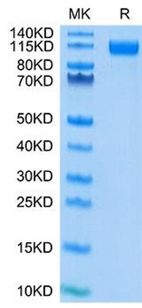 Recombinant SARS-COV-2 Spike S1(D614G) Protein (RPCB1856)