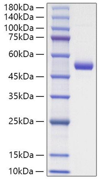 Recombinant Mouse GITR Ligand/TNFSF18 Protein (RPCB1868)