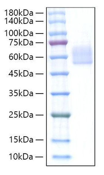 Recombinant Mouse Dkk-3 Protein (RPCB1896)