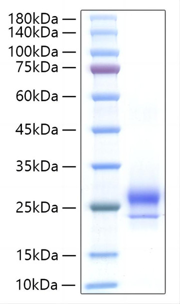 Recombinant Human IFN-alpha H2/IFNA14 Protein (RPCB1898)