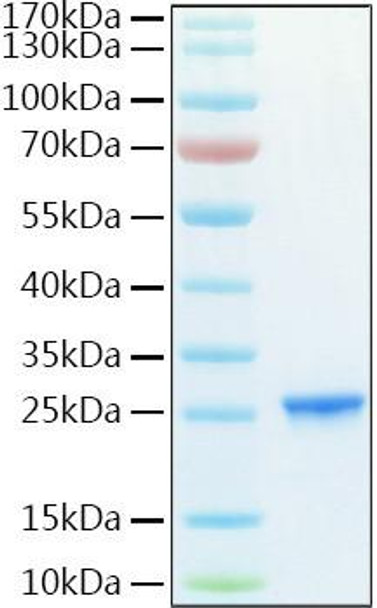 Recombinant Human PMKase/PMVK Protein (RPCB1907) Recombinant Human PMKase/PMVK Protein (RPCB1907)
