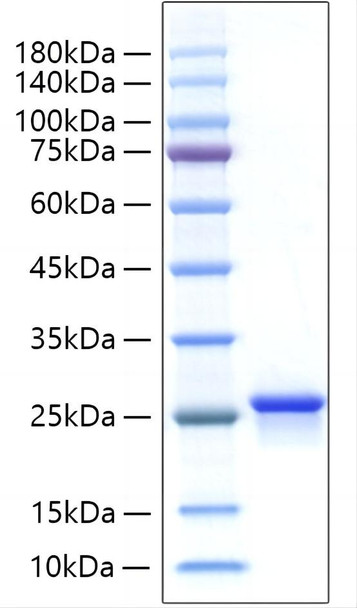 Recombinant Human IFN-alpha B2/IFNA8 Protein (RPCB1908)