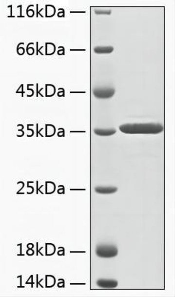 Recombinant Human Aminoacylase-3/ACY 3 Protein (RPCB1928) Recombinant Human Aminoacylase-3/ACY 3 Protein (RPCB1928)