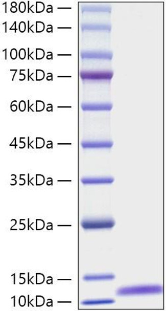 Recombinant Mouse Complement C5A Protein (RPCB1934)
