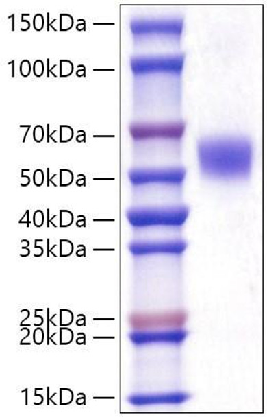 Recombinant Human LAP3 Protein (RPCB1941) Recombinant Human LAP3 Protein (RPCB1941)