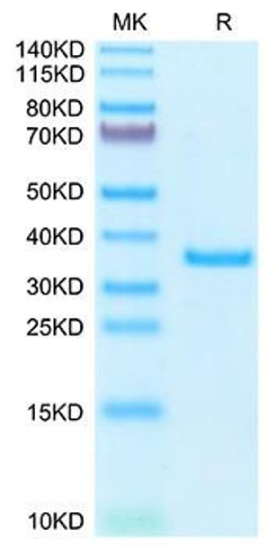 Recombinant Human SFRP2 Protein (RPCB1954)