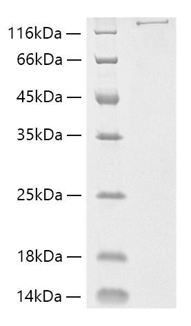 Recombinant Streptococcus pyogenes M1 Cas9 Protein (RPCB1964)