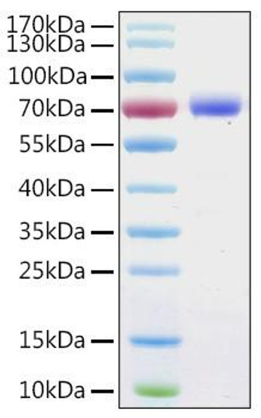Recombinant Human Annexin A6/ANXA6 Protein (RPCB1976) Recombinant Human Annexin A6/ANXA6 Protein (RPCB1976)