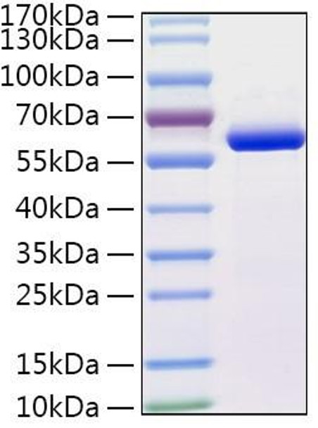 Recombinant Human CTSA Protein (RPCB2000)