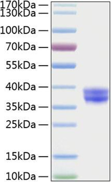 Recombinant Human CADM3/IGSF4B Protein (RPCB2017)