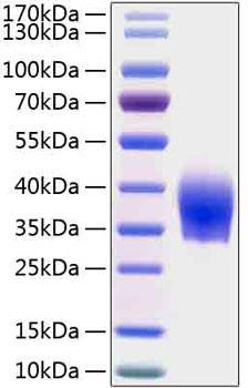 Recombinant Human SLAMF6/NTB-A/CD352 Protein (RPCB2018)