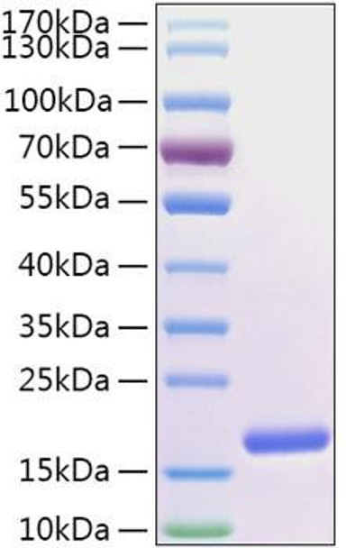 Recombinant Human FABP5/E-FABP Protein (RPCB2021)