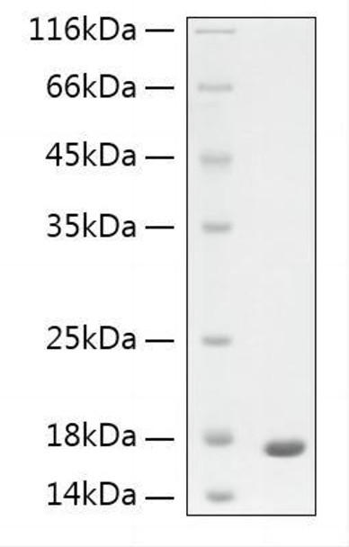 Recombinant Human GFAP protein (RPCB2028)