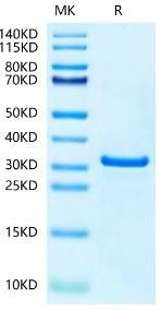 Recombinant Human NUDT5 Protein (RPCB2040)