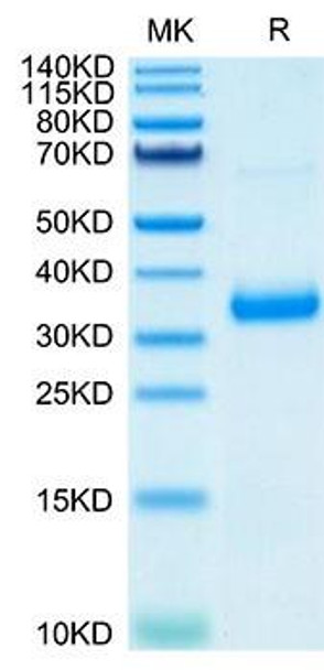 Recombinant SARS-COV-2 Spike RBD (N501Y,K417N,E484K) Protein (RPCB2051)