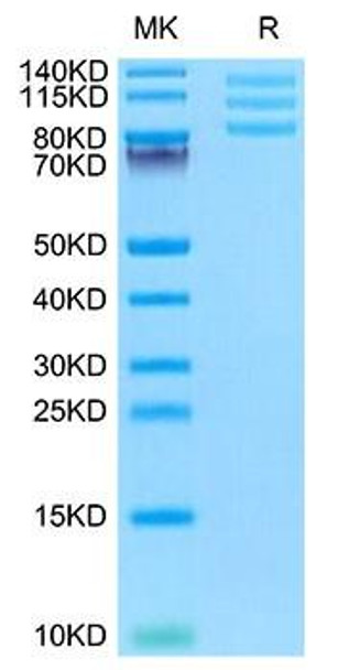 Recombinant Mouse Integrin alpha V beta 8 (ITGAV&ITGB8) Heterodimer Protein (RPCB2094)