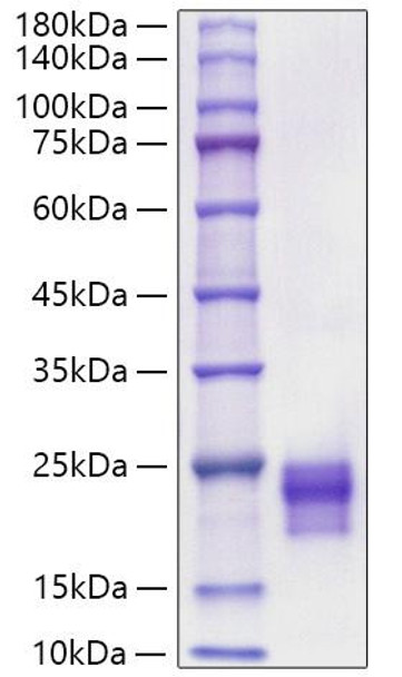 Recombinant Mouse/Rat VEGF-C Protein (RPCB2113)
