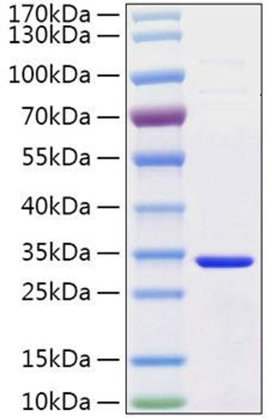Recombinant Human Secretagogin/SCGN Protein (RPCB2114)