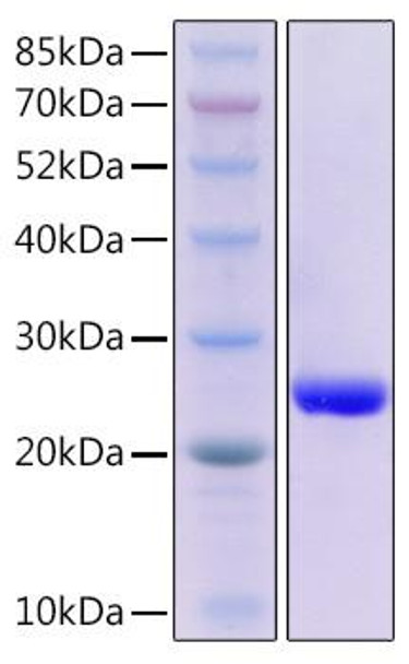 Recombinant Mouse TNFSF6/FAS ligand/CD178 Protein (RPCB2116)