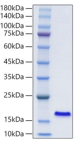 Recombinant Human FABP2/I-FABP Protein (RPCB2121) Recombinant Human FABP2/I-FABP Protein (RPCB2121)