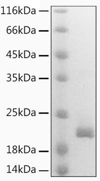 Recombinant Mouse Lymphotactin/XCL1 Protein (RPCB2126)