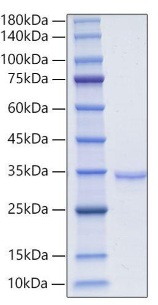 Recombinant Human Granzyme A/CTLA-3/GZMA Protein (RPCB2127) Recombinant Human Granzyme A/CTLA-3/GZMA Protein (RPCB2127)