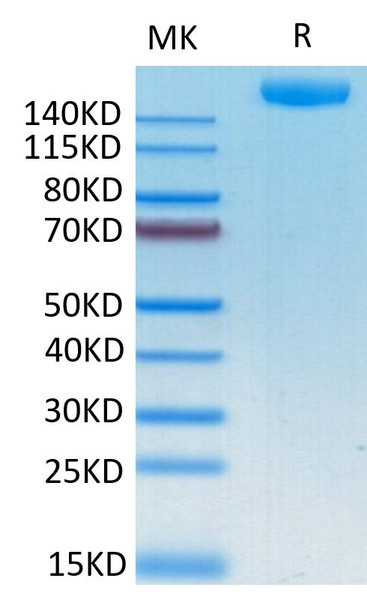 Recombinant SARS-COV-2 Spike S1+S2 ECD (S-ECD) Protein (RPCB2131)