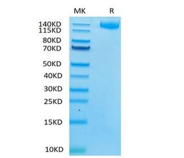 Recombinant Human Leukemia inhibitory factor receptor/LIF-R/CD118 Protein (RPCB2144)