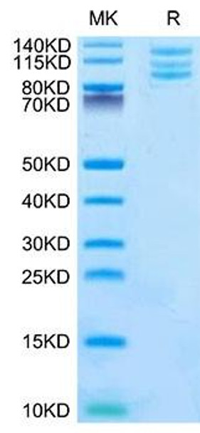 Recombinant Mouse Integrin alpha V beta 6 (ITGAV&ITGB6) Heterodimer Protein (RPCB2173)