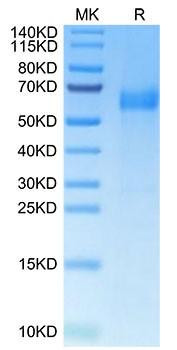 Recombinant Human B7-H7/HHLA2 Protein (RPCB2175)