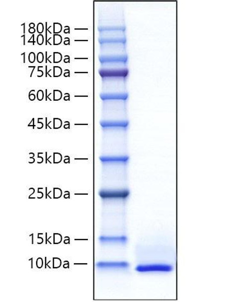 Recombinant Mouse CXCL5/ENA-70 Protein (RPCB2199)