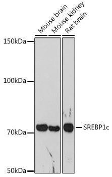 Anti-SREBP1 Antibody (CAB15586)