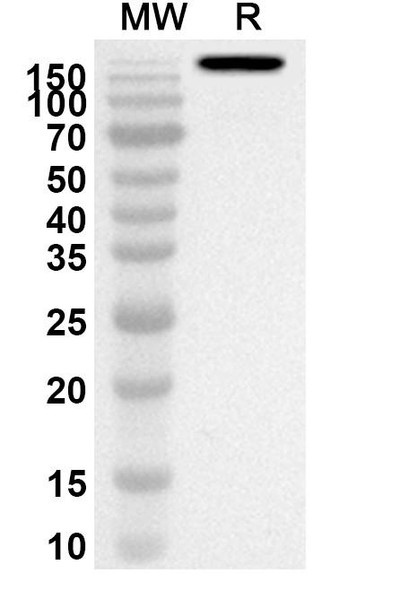 Anti-Golimumab Polyclonal Antibody