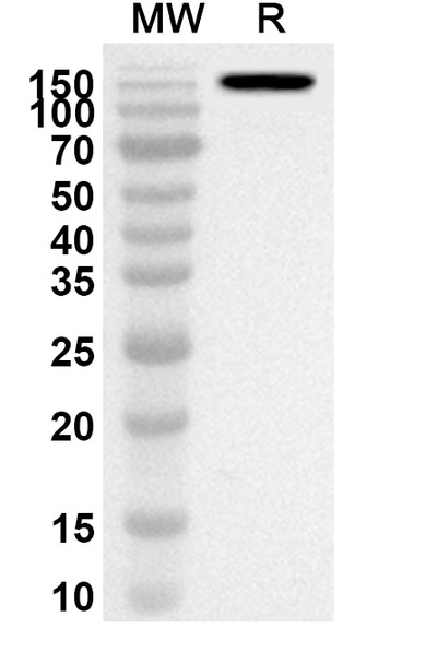 Anti-Etanercept Polyclonal Antibody