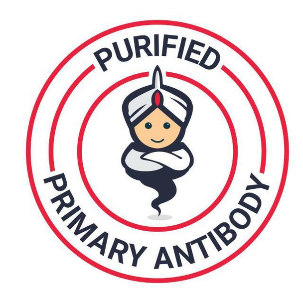 Anti-Belimumab Polyclonal Antibody